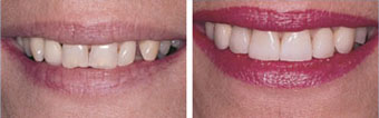 Cosmetic Dentistry