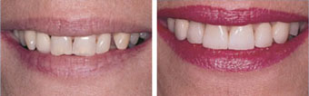 Cosmetic Dentistry